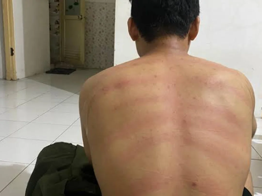 Jasa Pijat Plus Kerokan Panggilan  Terpercaya  di uluwatu 2